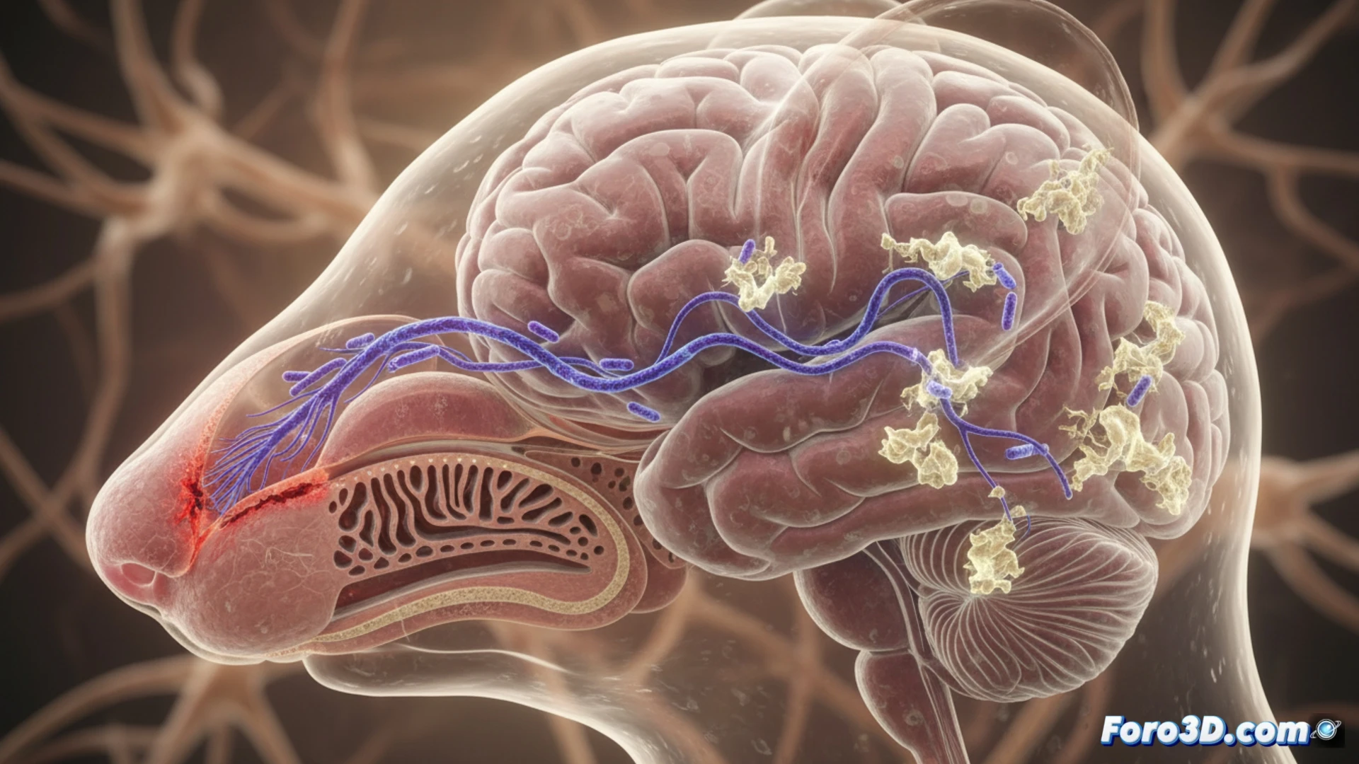 Representación 3D de la ruta de la bacteria Chlamydia pneumoniae desde la cavidad nasal al cerebro a través del nervio olfativo.