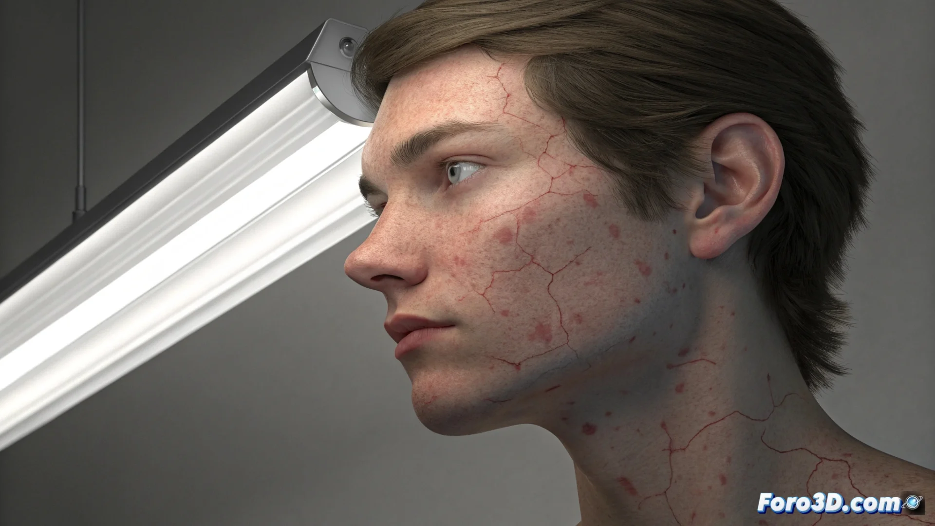 Can Fluorescent Lamps Affect Photosensitive Skin?