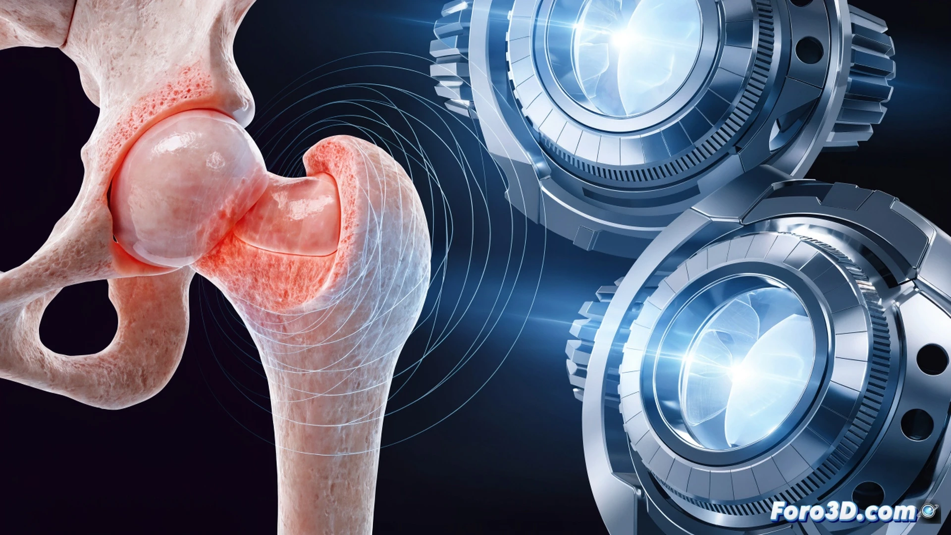 non-invasive magnetic stimulation device positioned near a human hip joint, glowing magnetic field lines penetrating through skin and muscle toward the femoral head and acetabulum, dormant chondrocytes within cartilage layers reactivating with visible metabolic sparkles, technical medical illustration style, photorealistic rendering, cross-section view showing layered anatomy from skin to bone, soft blue and teal magnetic flux lines, subtle cellular glow effects, clean clinical lighting, high detail on device coils and joint structure, no text or labels, cinematic medical visualization