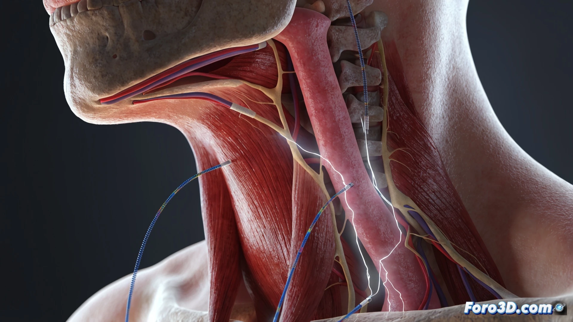 Transcutaneous electrical stimulation device on a patient neck, two adhesive electrodes placed over suprahyoid muscles, low-voltage impulses activating throat muscles during swallowing process, medical professional adjusting intensity on handheld controller with digital display, patient sitting upright in clinical chair, visible muscle contraction under skin during deglutition attempt, soft clinical lighting, photorealistic medical illustration, sterile hospital background, detailed skin texture, electrode wires tracing to portable stimulator unit, calm therapeutic atmosphere