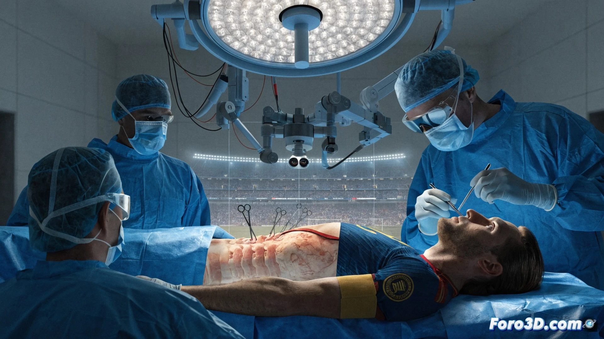 Professional medical illustration showing Rodri lying on a surgical table during an ambulatory procedure, surgeons performing a minimally invasive spinal correction with robotic assistance, glowing holographic spine scan above the patient showing a small blue-highlighted lesion area, arthroscopic tools and monitoring screens displaying vital signs, sterile blue drapes and bright operating lights, calm clinical environment, photorealistic cinematic medical visualization, soft cool lighting, detailed surgical equipment and anatomical precision, no text or numbers visible in the scene