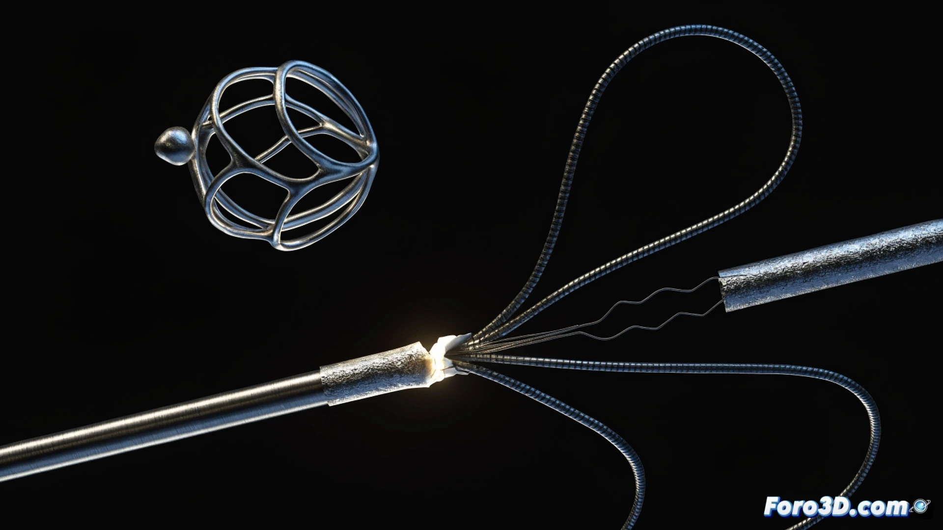 Rotura de catéter endovascular: el misterio de la punta perdida