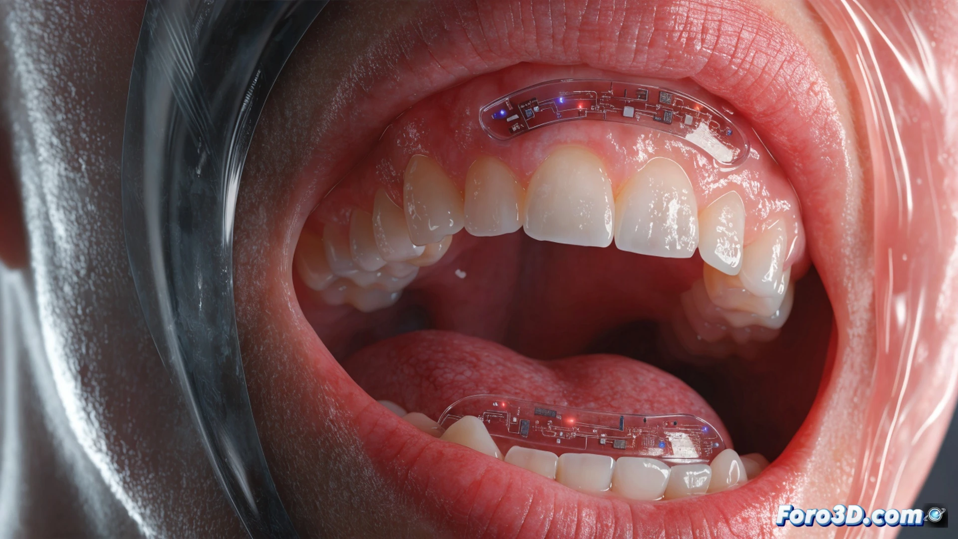 close-up of a transparent dental mouthguard embedded with a microchip and gold sensor traces, a hand inserting the mouthguard into an open mouth, saliva droplets shimmering on the sensor surface, glowing blue electrical pathways inside the chip, cross-section view showing transistor layers analyzing fluid in real-time, cinematic engineering visualization, photorealistic medical technology, soft clinical lighting, macro lens detail on microelectronics, clean white background with subtle gradient, no text or numbers visible