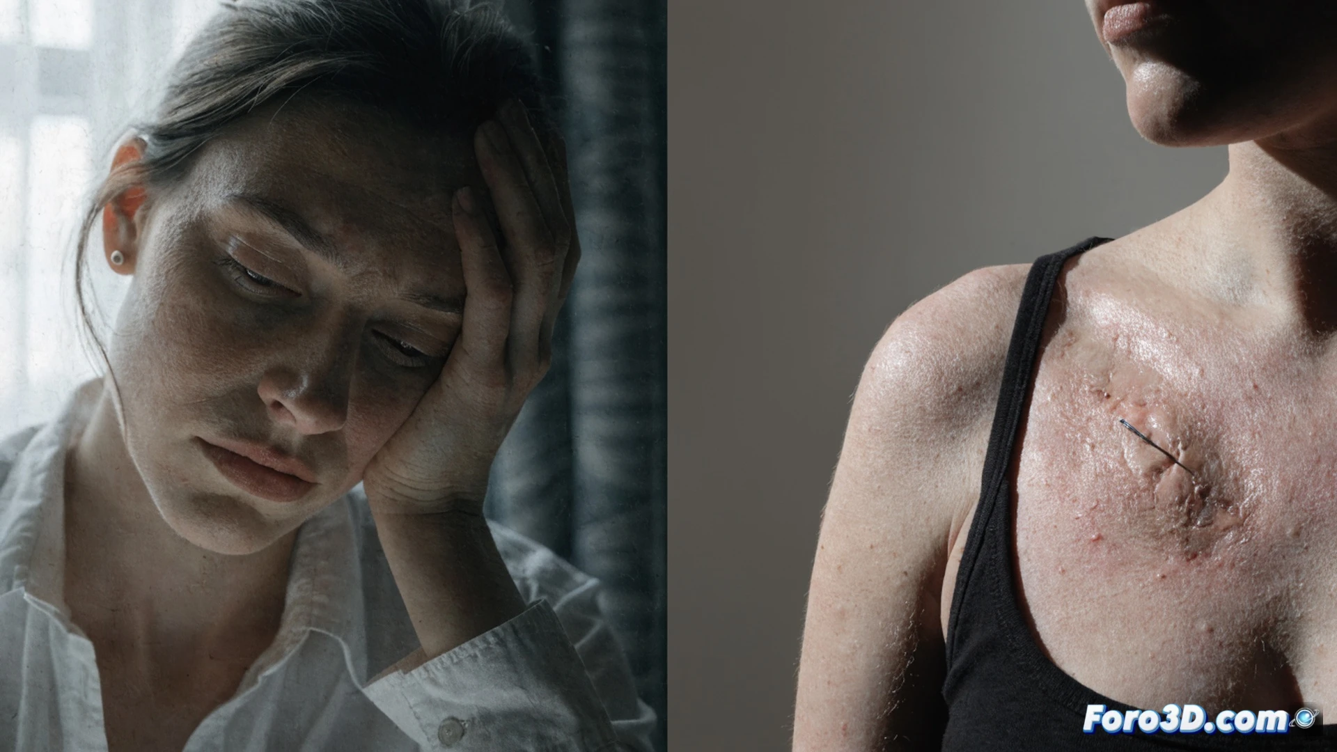 woman standing in front of a bathroom mirror, one hand touching her flat chest scar after mastectomy, reflection shows her face with mixed sadness and acceptance, scattered medical supplies on sink, crumpled hospital bracelet on counter, soft clinical lighting, photorealistic cinematic style, shallow depth of field, skin texture visible, muted color palette with pale blue and grey tones, emotional tension in posture, hyperrealistic medical drama aesthetic