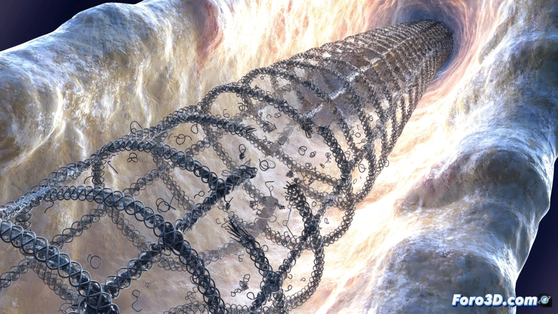 Stent traqueal fracturado en modelo 3D para análisis de fatiga y planificación quirúrgica de extracción segura