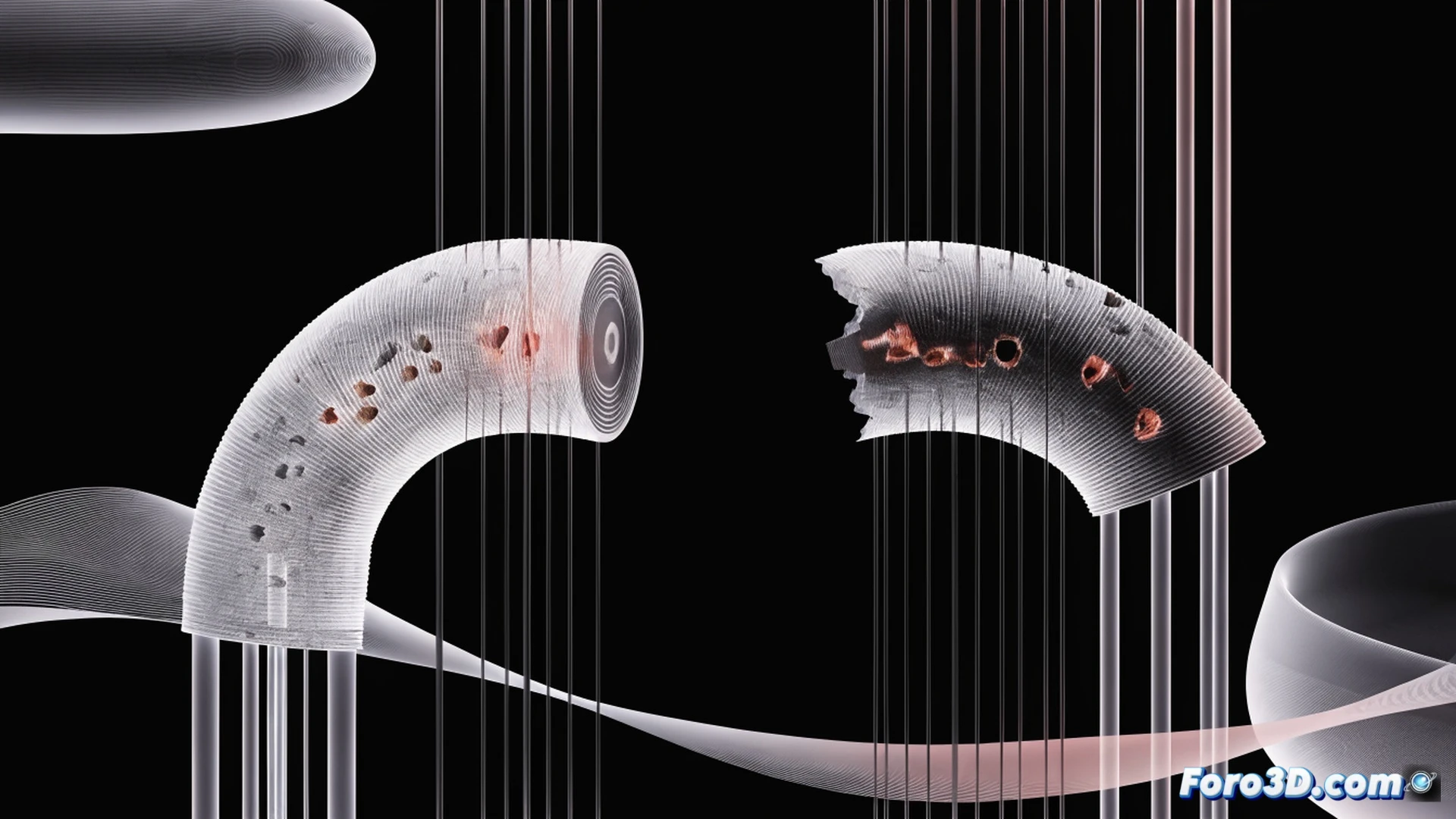 Microscopic cross-section of a vascular guidewire tip during fatigue fracture, showing micro-porosity voids inside the metallic structure, crack propagation lines spreading from a cluster of tiny pores, simulation software interface panels floating in the background displaying VGSTUDIO MAX volume rendering and Ansys stress heatmap, engineering visualization style, ultra-detailed metallic grain texture, dramatic side lighting revealing internal defects, photorealistic technical illustration, high contrast between solid metal and void spaces, cinematic depth of field focusing on the crack origin point