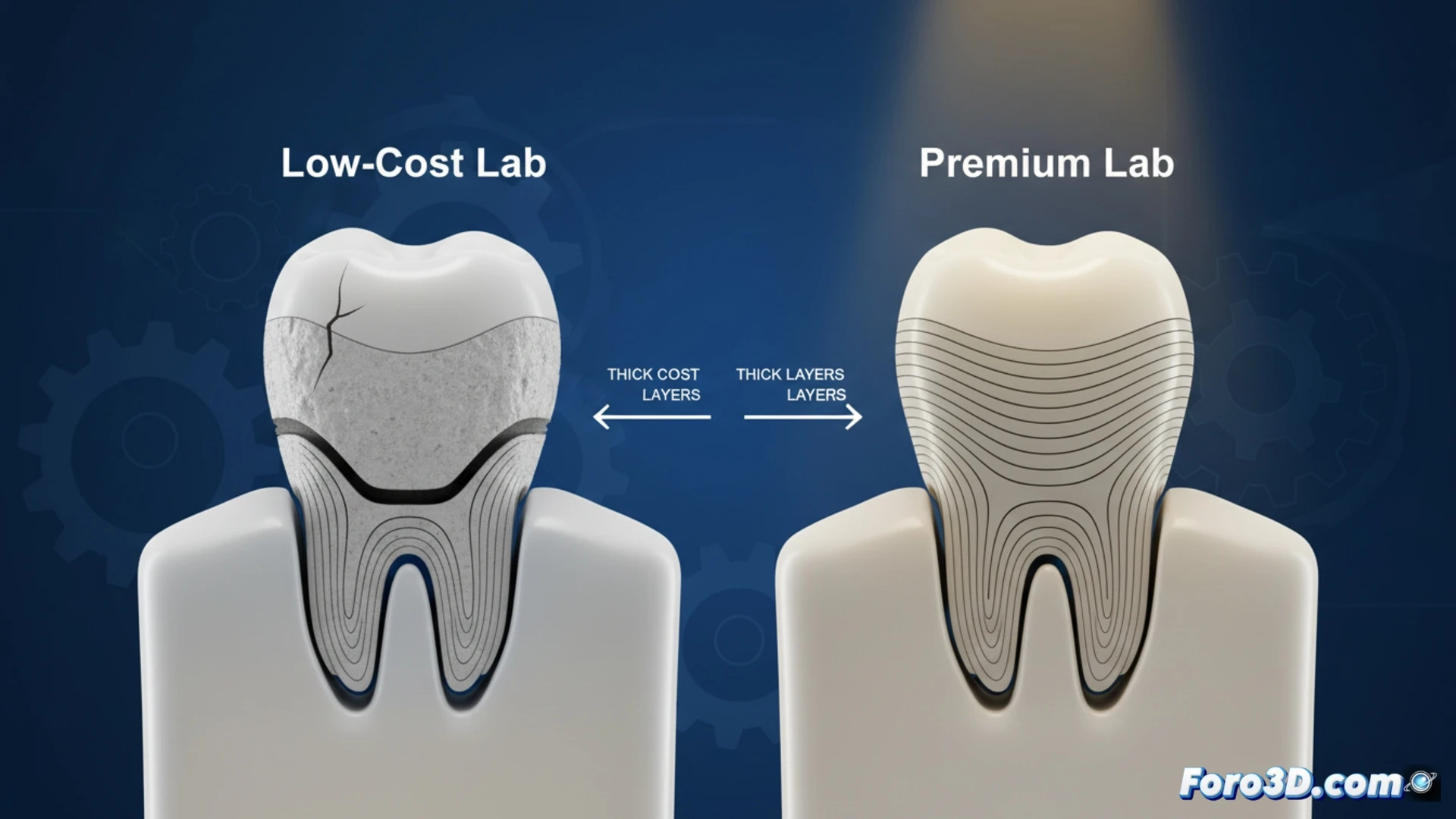 Photorealistic technical illustration of a 3D-printed dental crown cross-section, showing multiple thin layers separating and cracking under pressure, a robotic dental arm applying force with a precision gauge, digital caliper measuring layer thickness on a monitor displaying CAD software with highlighted stress points, broken crown fragments falling onto a laboratory workbench next to a low-cost printer with a timer showing extended production delay, cinematic lighting emphasizing the fragile layered structure, engineering visualization style, ultra-detailed ceramic texture, sharp focus on failure zones.