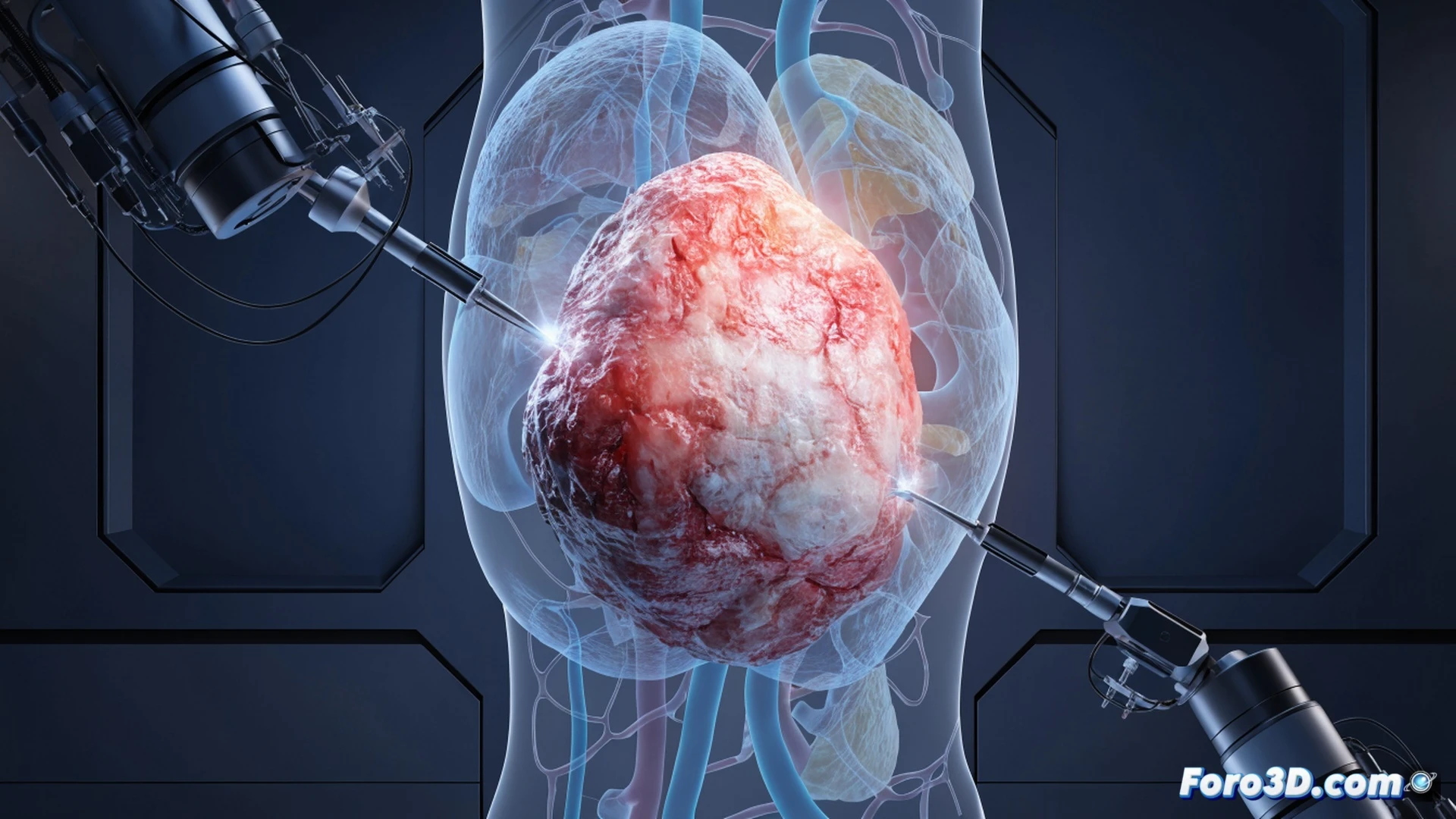 Robotic surgical arms positioned above a translucent 3D holographic liver tumor model, surgeons analyzing the projection in a darkened operating room, precision instruments moving in synchronized motion during a simulated procedure, monitors displaying real-time anatomical mapping, metallic robotic joints with blue LED accents, sterile white environment with dramatic low-angle lighting, cinematic photorealistic technical illustration, ultra-detailed medical visualization, clean futuristic aesthetic