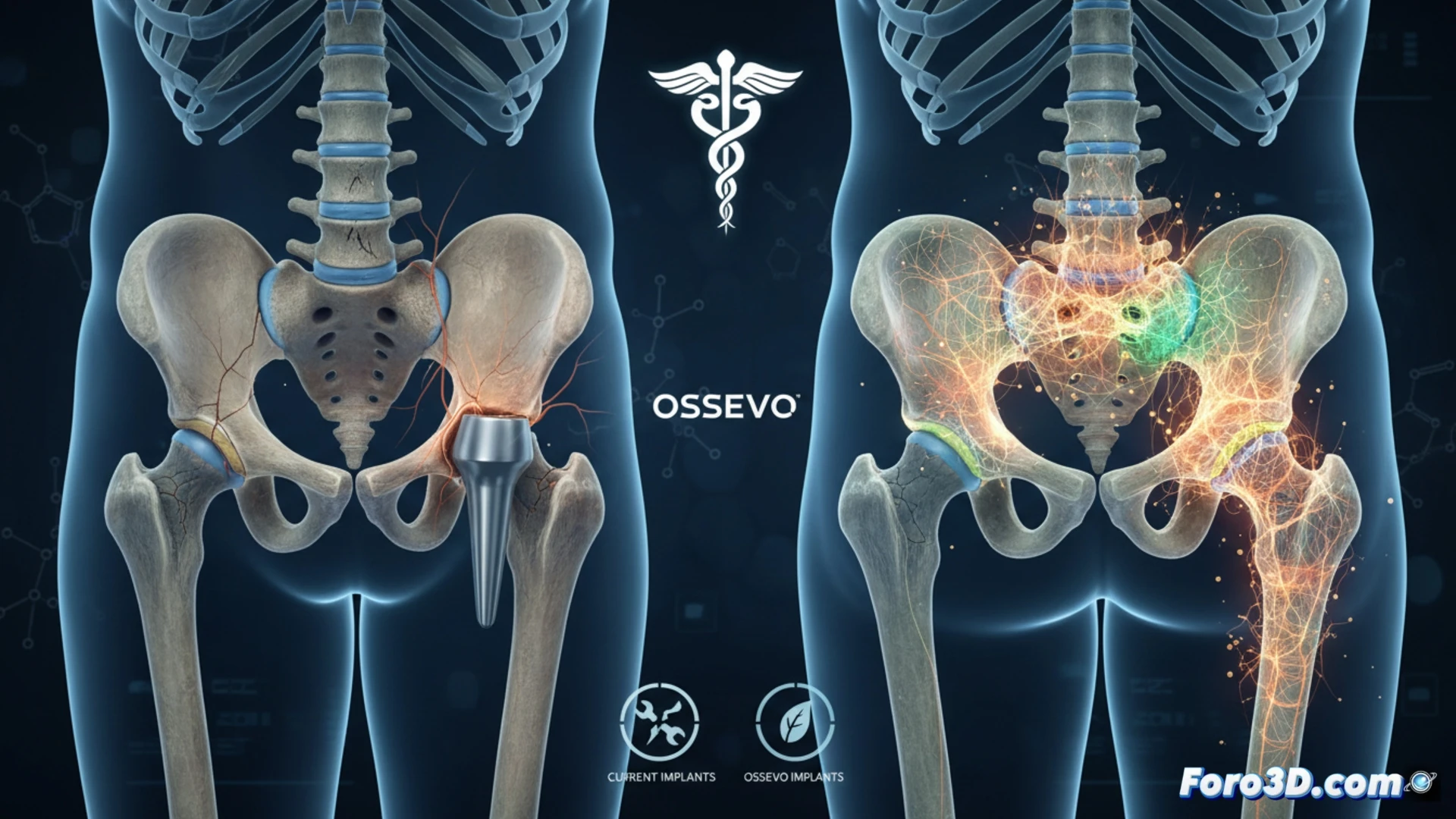 engineering visualization of a prosthetic bone implant being stress-tested inside a transparent biomechanical chamber, robotic arm applying compressive force onto the implant while a digital overlay shows stress distribution heatmap, implant surface replicating porous trabecular bone structure, adjacent real bone section for comparison, both embedded in simulated tissue gel, high-contrast lighting highlighting the lattice architecture, photorealistic render, macro lens focus on material interface, subtle fracture lines absent on implant side, clean medical lab background