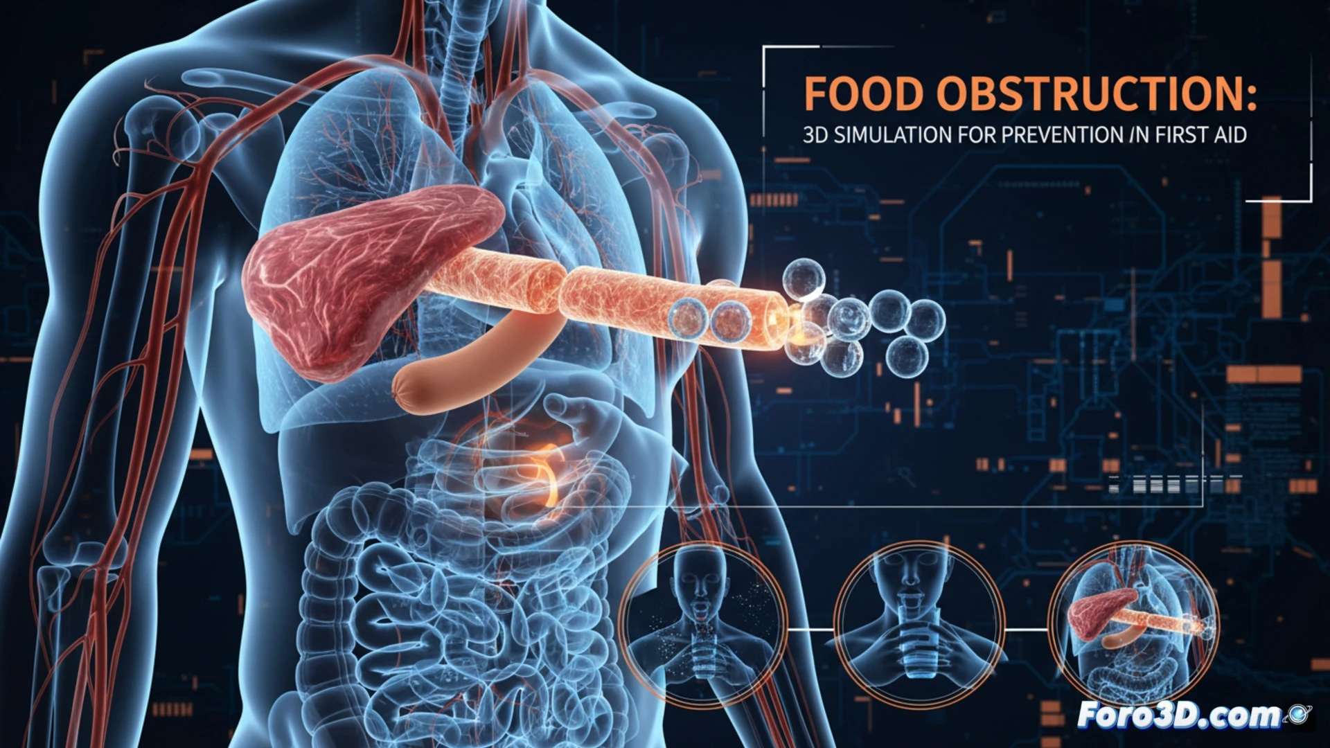 Simulación 3D de obstrucción alimentaria en esófago para prevención y primeros auxilios interactivos