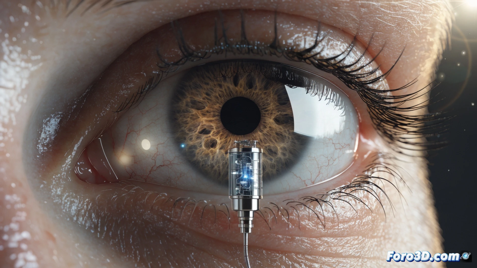 Oftalmólogo insertando un pequeño implante cilíndrico recargable en el ojo humano, dispositivo metálico con puerto de recarga visible, jeringa de precisión alineada sobre el implante durante el procedimiento, gotas de solución salina brillando bajo luz quirúrgica, fondo con monitor mostrando gráficos de liberación continua de medicación, manos enguantadas manipulando el dispositivo con pinzas esterilizadas, primer plano del ojo con el implante parcialmente insertado, estilo cinematic photorealistic medical illustration, iluminación fría de quirófano, texturas detalladas de tejido ocular y metal quirúrgico, composición vertical dramática
