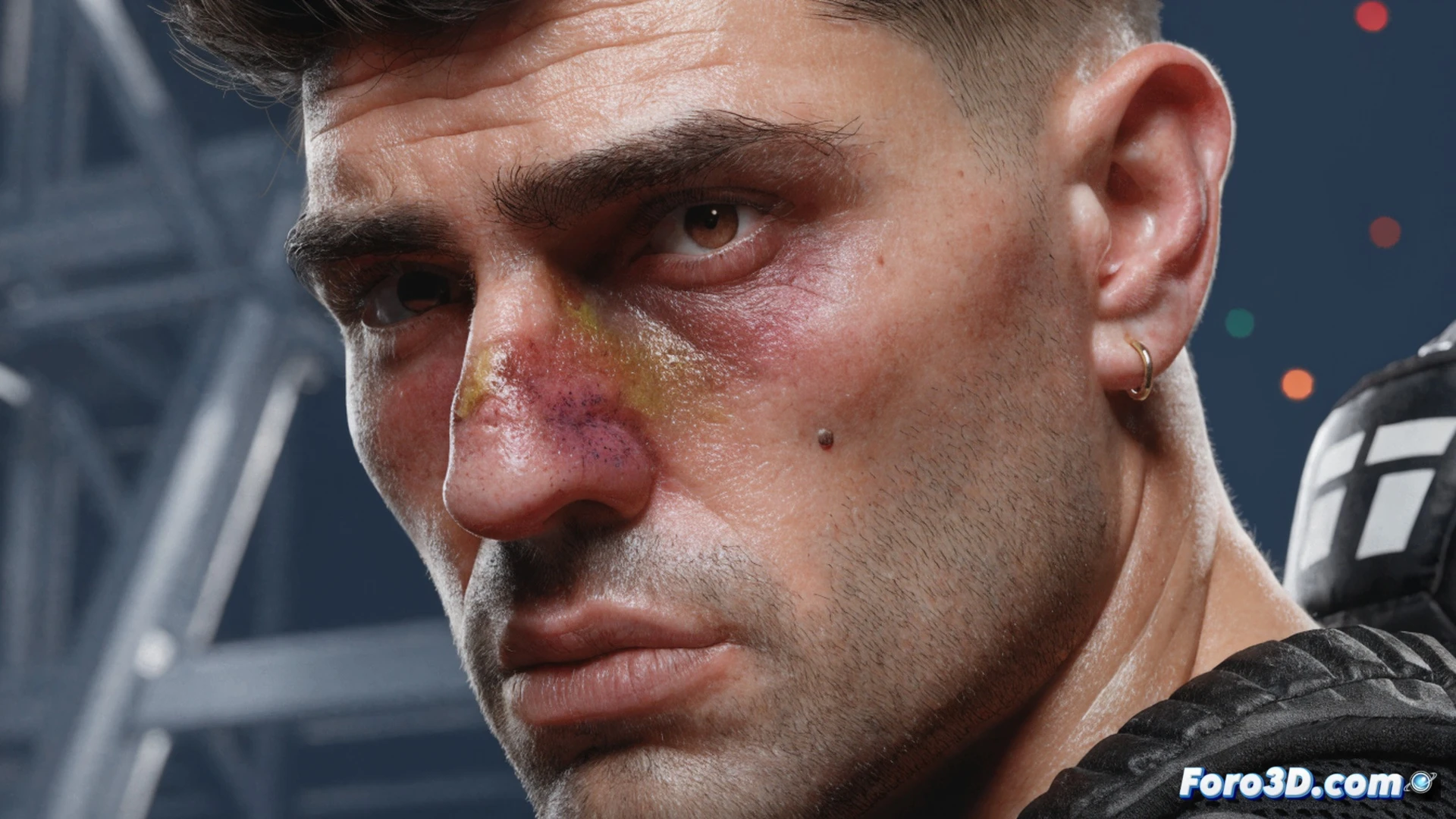 UFC octagon center, Ilia Topuria in protective face mask with nasal splint, medical team checking his nose with otoscope and cold spray, fractured nasal bone visible on digital X-ray tablet held by doctor, calendar hologram showing postponed fight date, gym equipment blurred in background, cinematic photorealistic medical sports visualization, dramatic spotlight on fighter, swelling and bruising around nose, ice pack on side table, trainers looking concerned, realistic skin texture and blood vessels, high-end 8K render