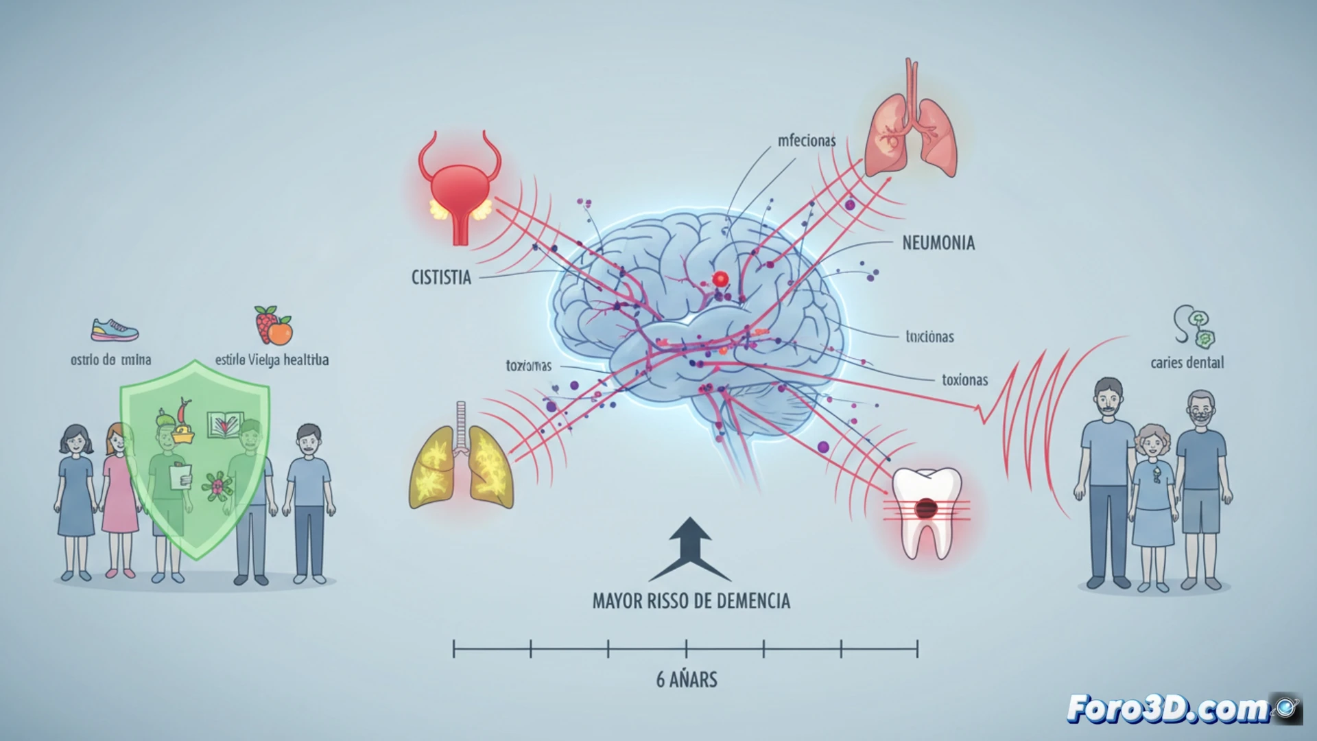 Infecciones graves y demencia: visualizando el vínculo epidemiológico