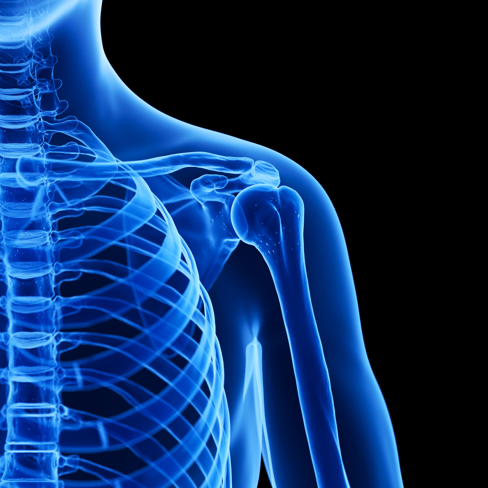 Clic en la imagen para ver su versión completa. 

Nombre: 652_SFI_skeleton_xray_b0014.jpg 
Visitas: 303 
Tamaño: 290.4 KB 
ID: 246944
